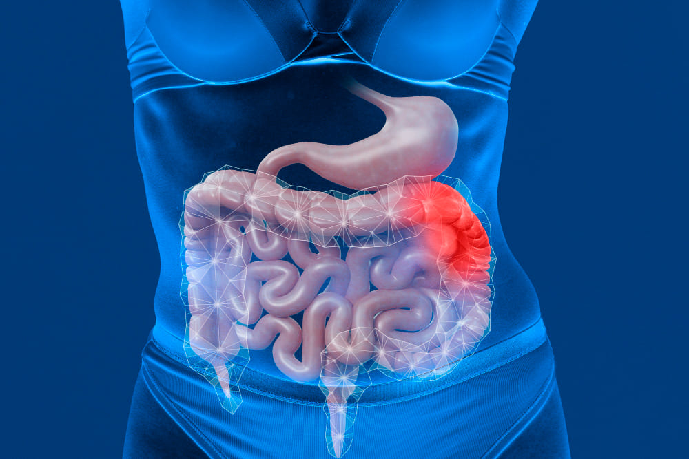 morbo di crohn diagnosi